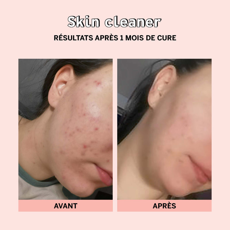 Skin cleaner | Gélules